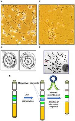 The Role of Genetics and Oxidative Stress in the Etiology of Male Infertility—A Unifying Hypothesis?